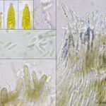 Fuscolachnum misellum_492